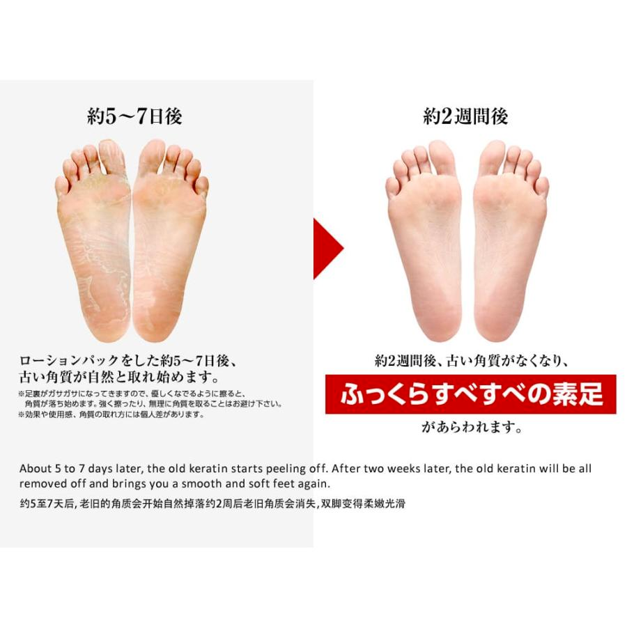 Ashiura Ran Run Express Horse Oil Foot Mask 1 pair