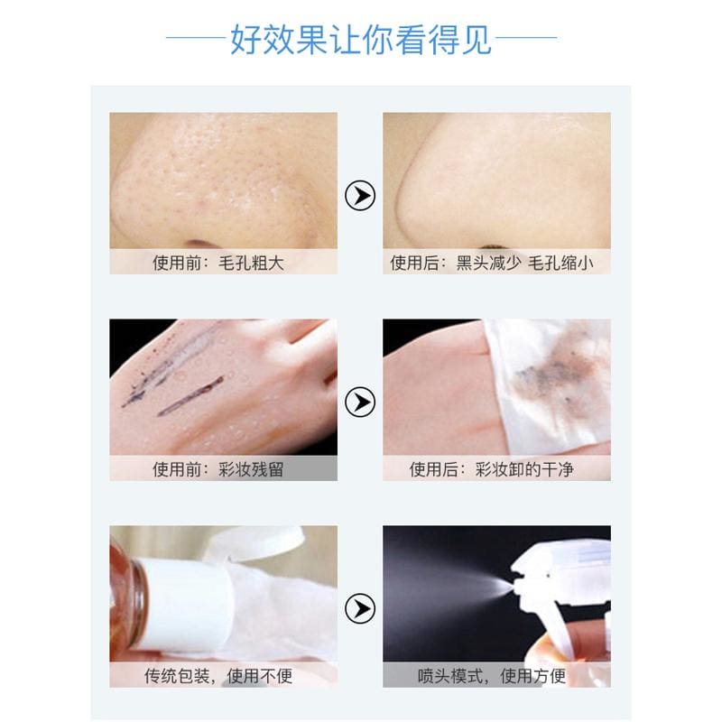 【NZ现货】日本水桥保寿堂去黑头喷雾二次清洁化妆水温和无刺激补水 - Japan2NZ